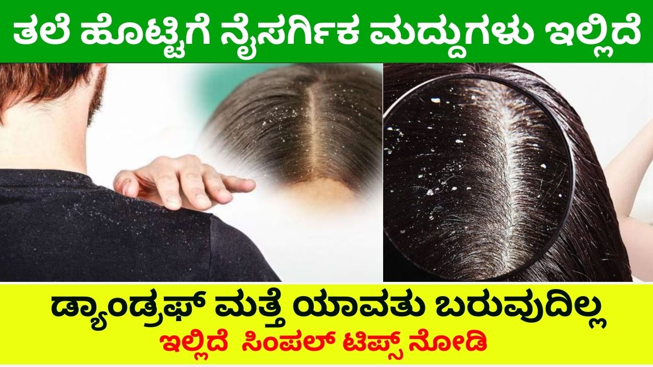 Permanent solution for dandruff